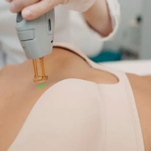 Areolas(001)