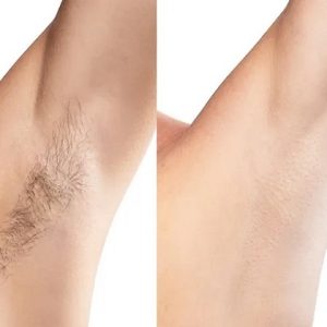 Underarms(001)