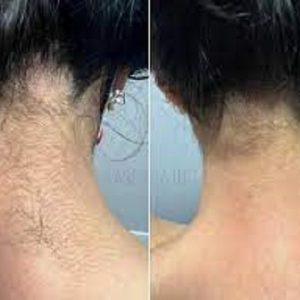 Neck (Back)(001)