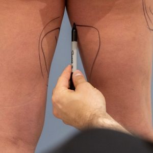 Inner Thighs(001)