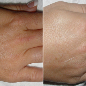 Hands & Fingers(001)