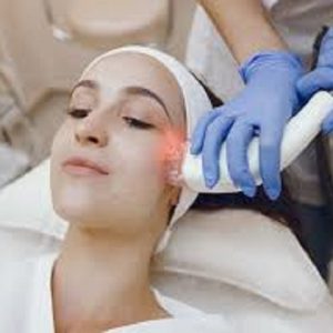 Laser Skin Tightening- 30 mins(001)