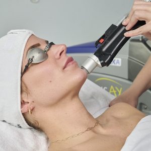Facial/Chemical Peel